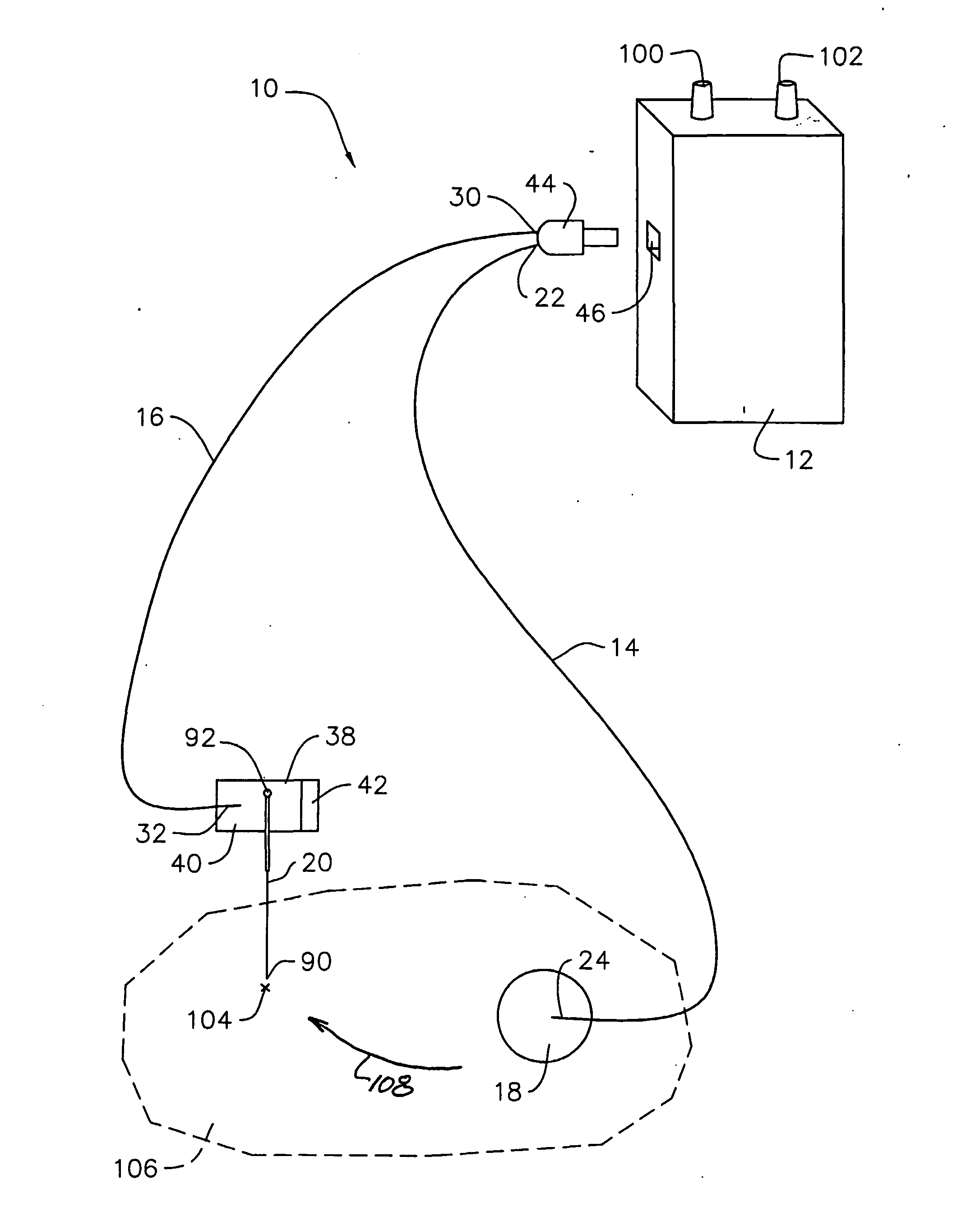 Electro-nerve stimulator system and methods