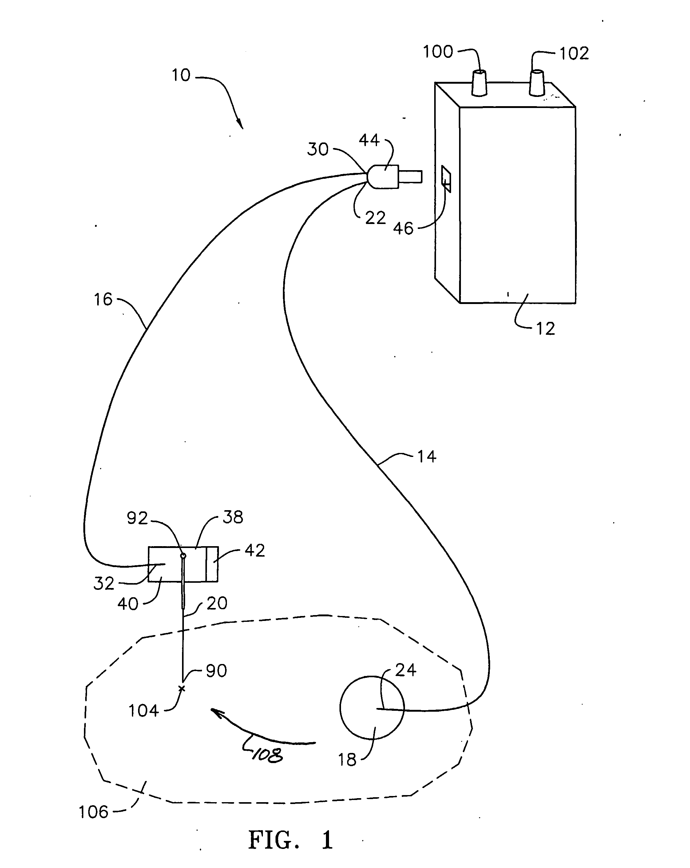 Electro-nerve stimulator system and methods