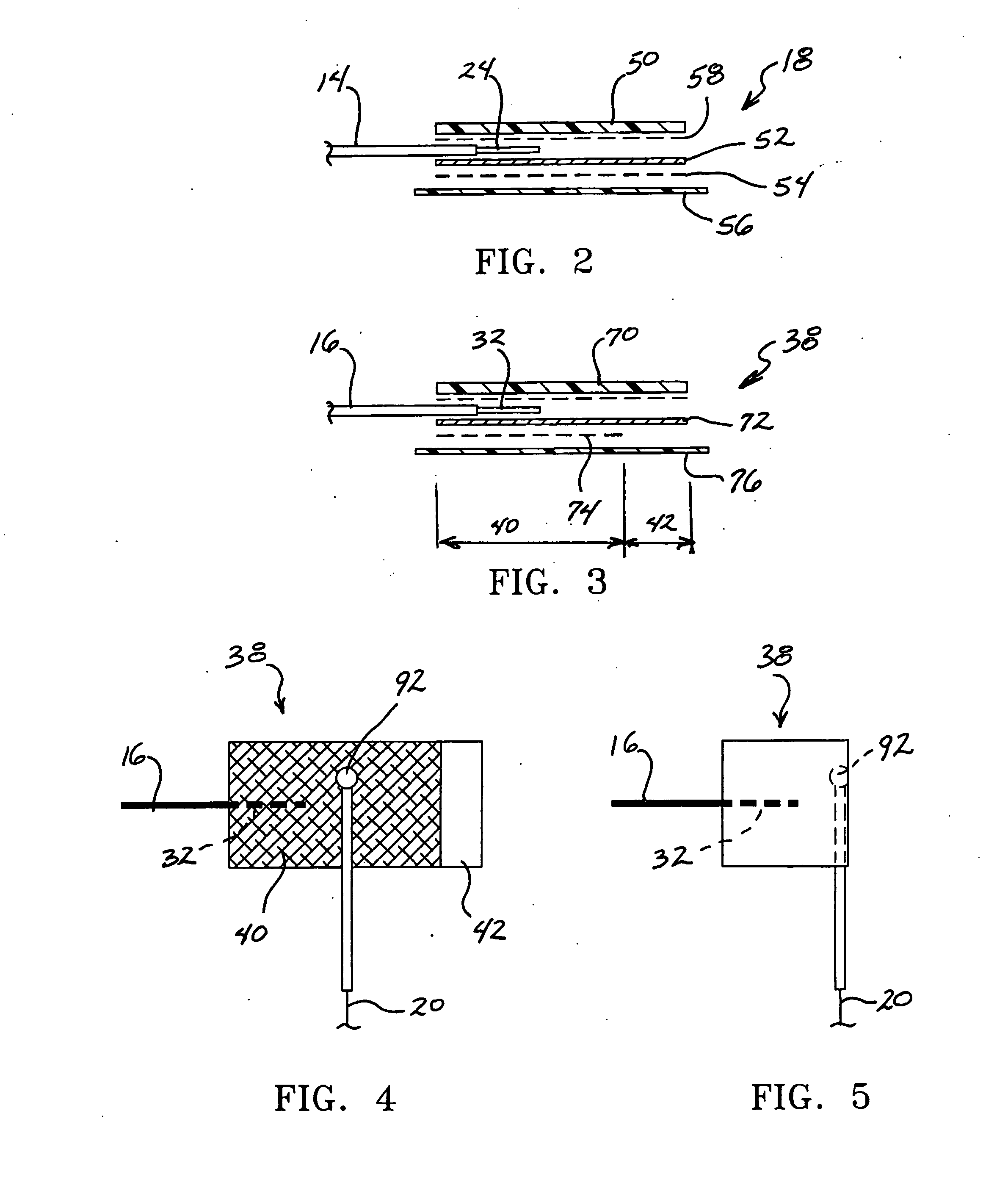 Electro-nerve stimulator system and methods