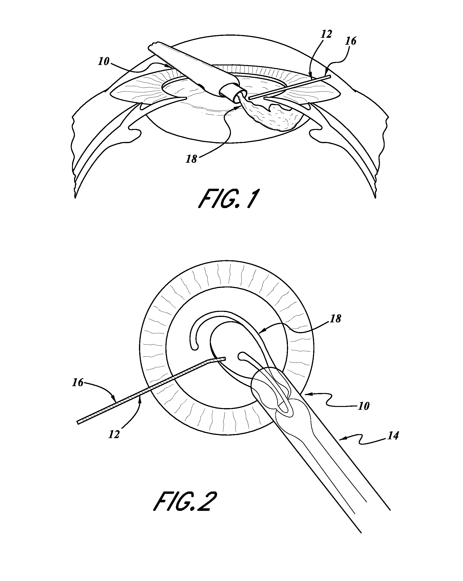 Intraocular lens inserter