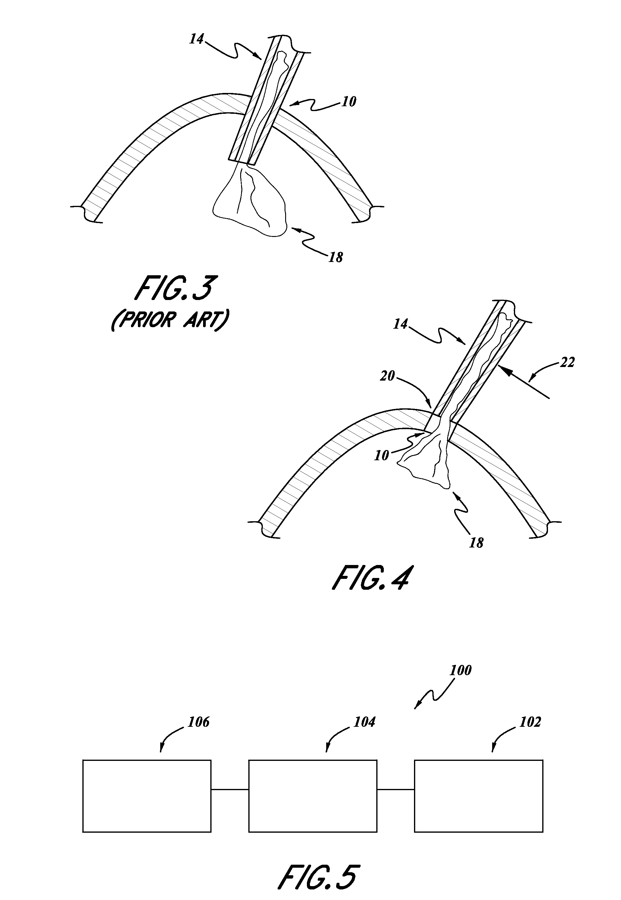 Intraocular lens inserter