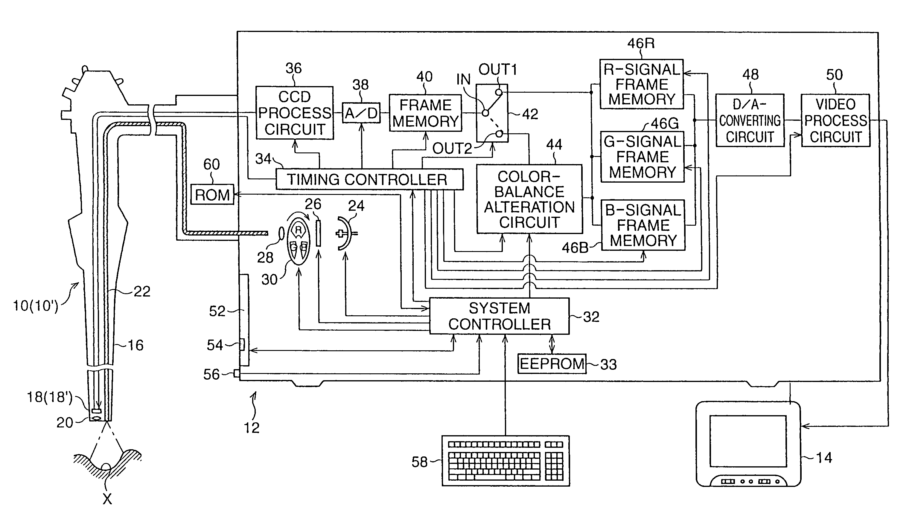 Electronic endoscope system with color-balance alteration process