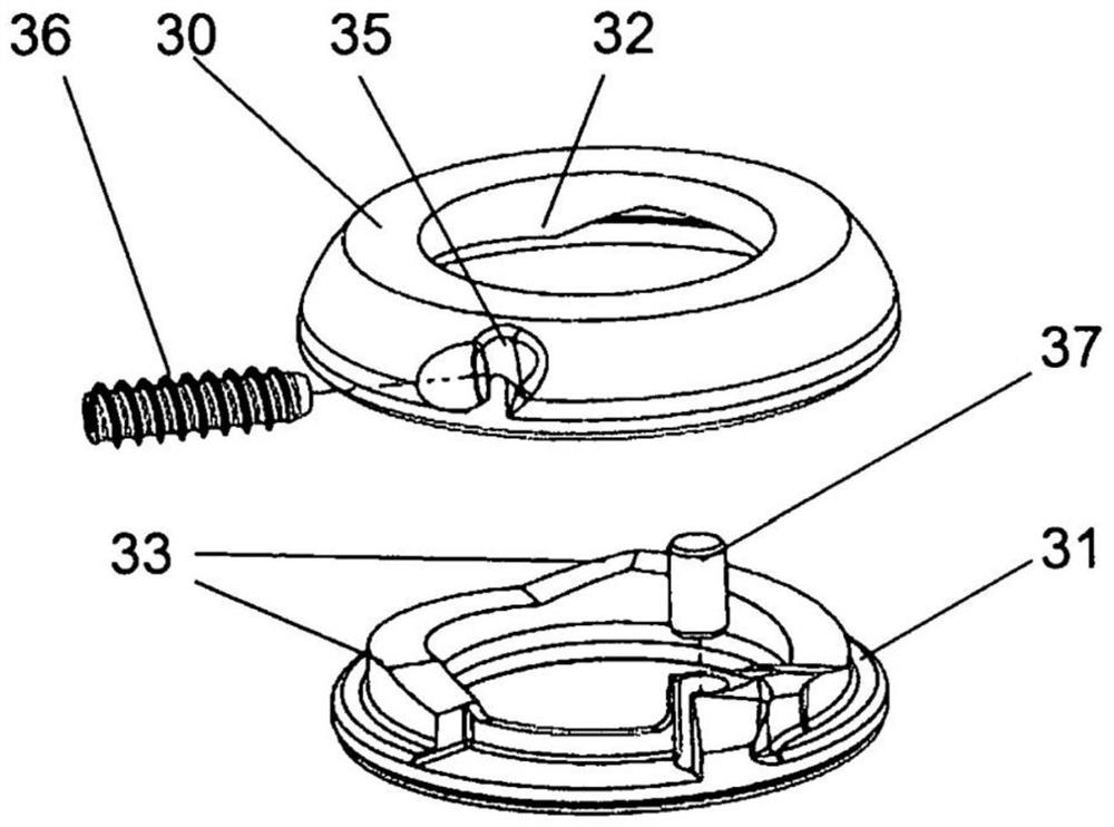 Device and arrangement system for adjusting bearing clearance