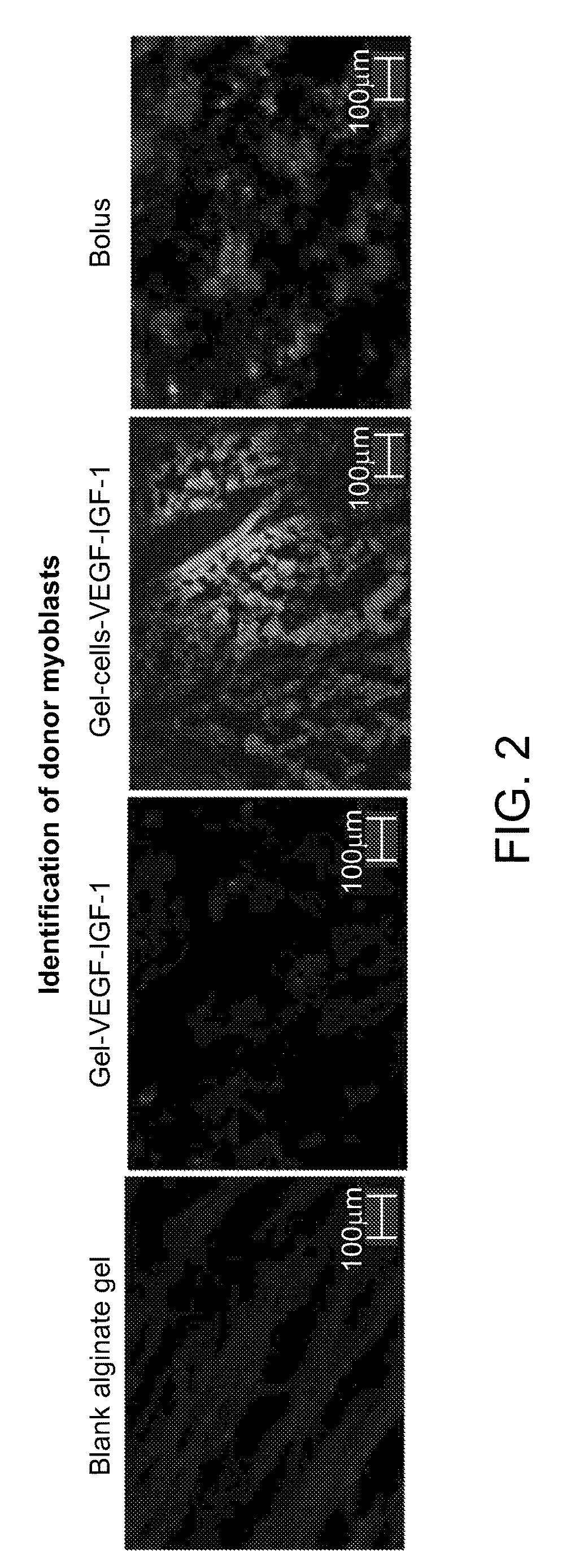 Enhancement of skeletal muscle stem cell engraftment by dual delivery of VEGF and IGF-1