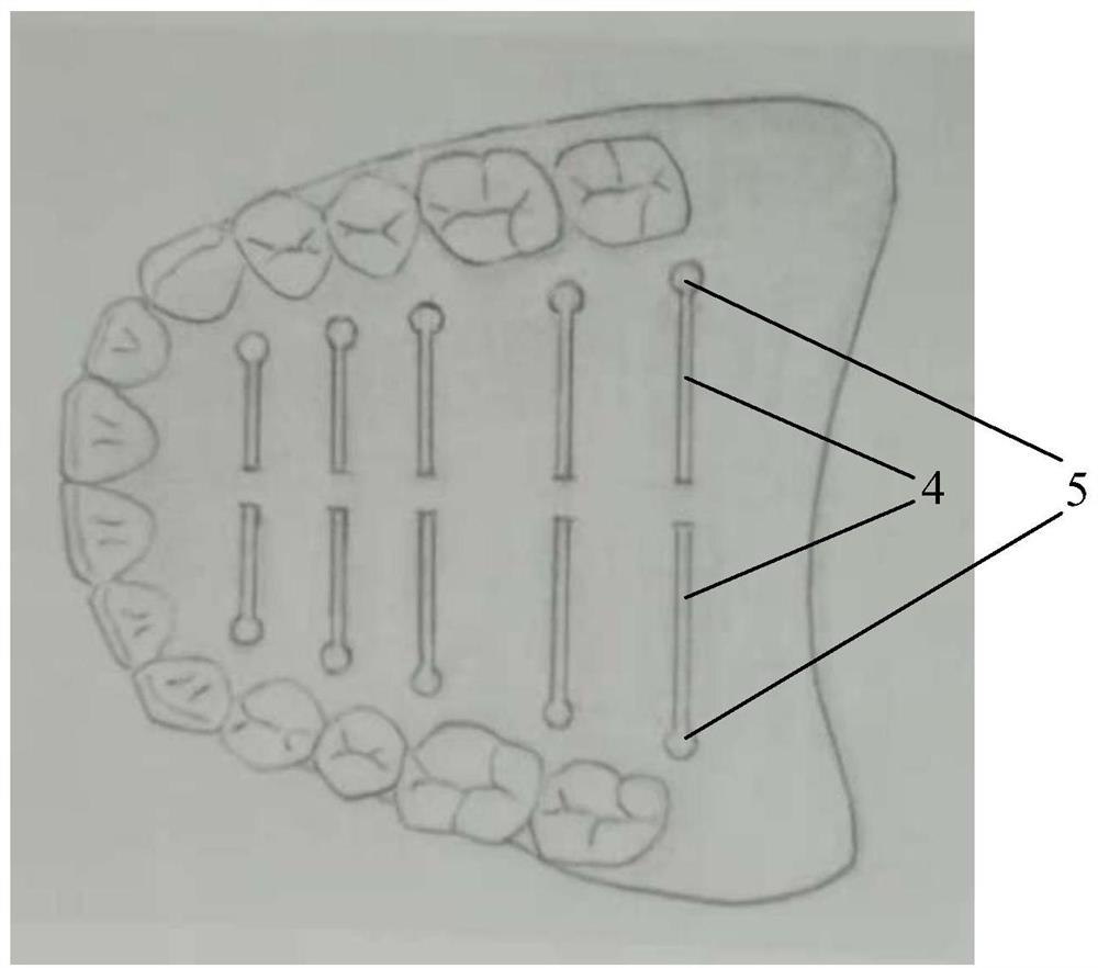 A kind of semi-finished complete denture based on prefabricated dentition structure and the rapid manufacturing method of complete denture