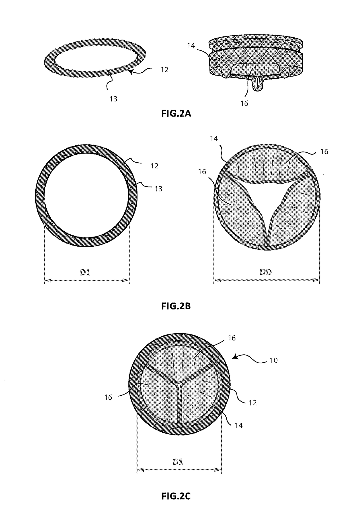 Cardiac valve prosthesis