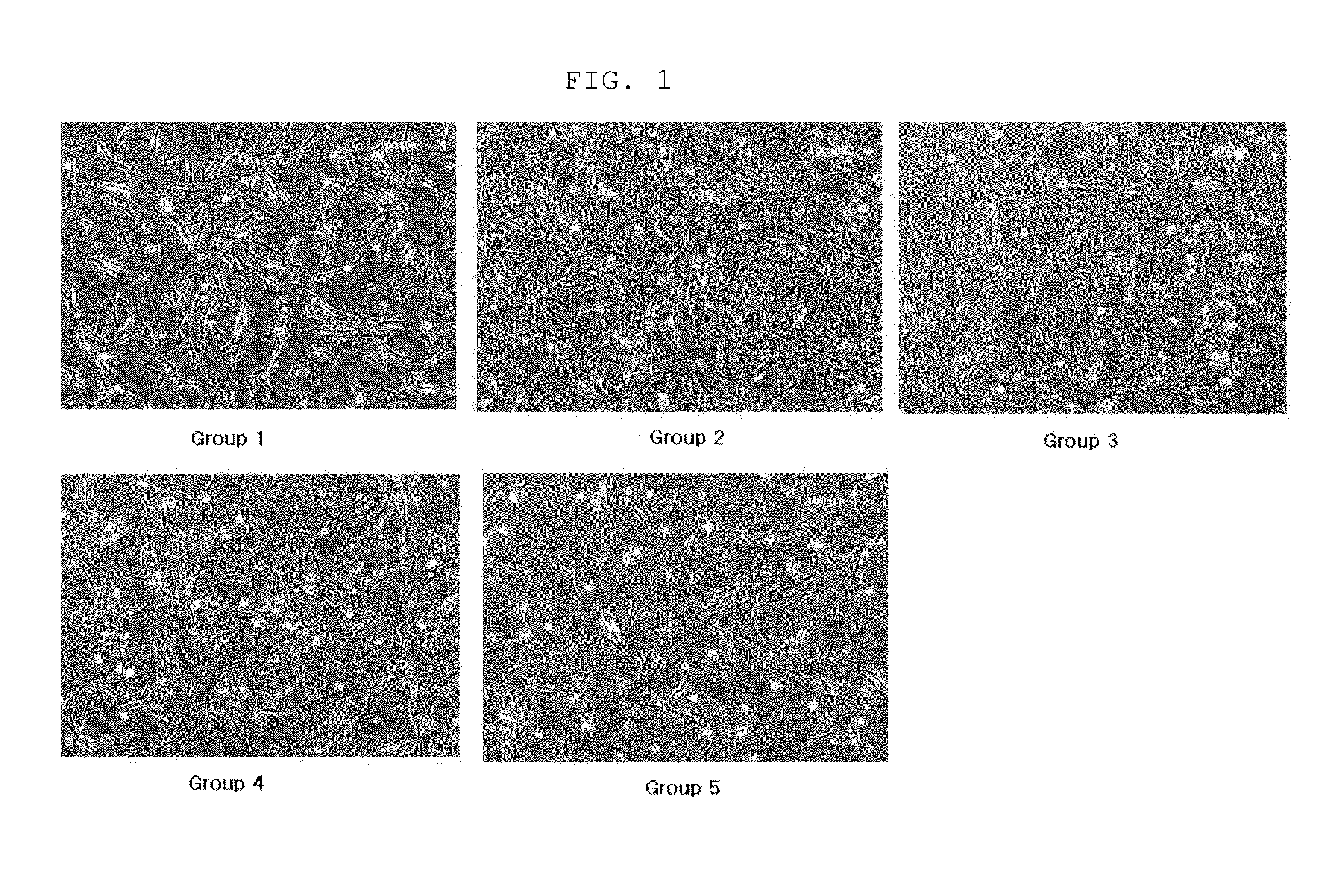 Culture medium composition for culturing amnion-derived mesenchymal stem cell, and method for culturing amnion-derived mesenchymal stem cell by using same