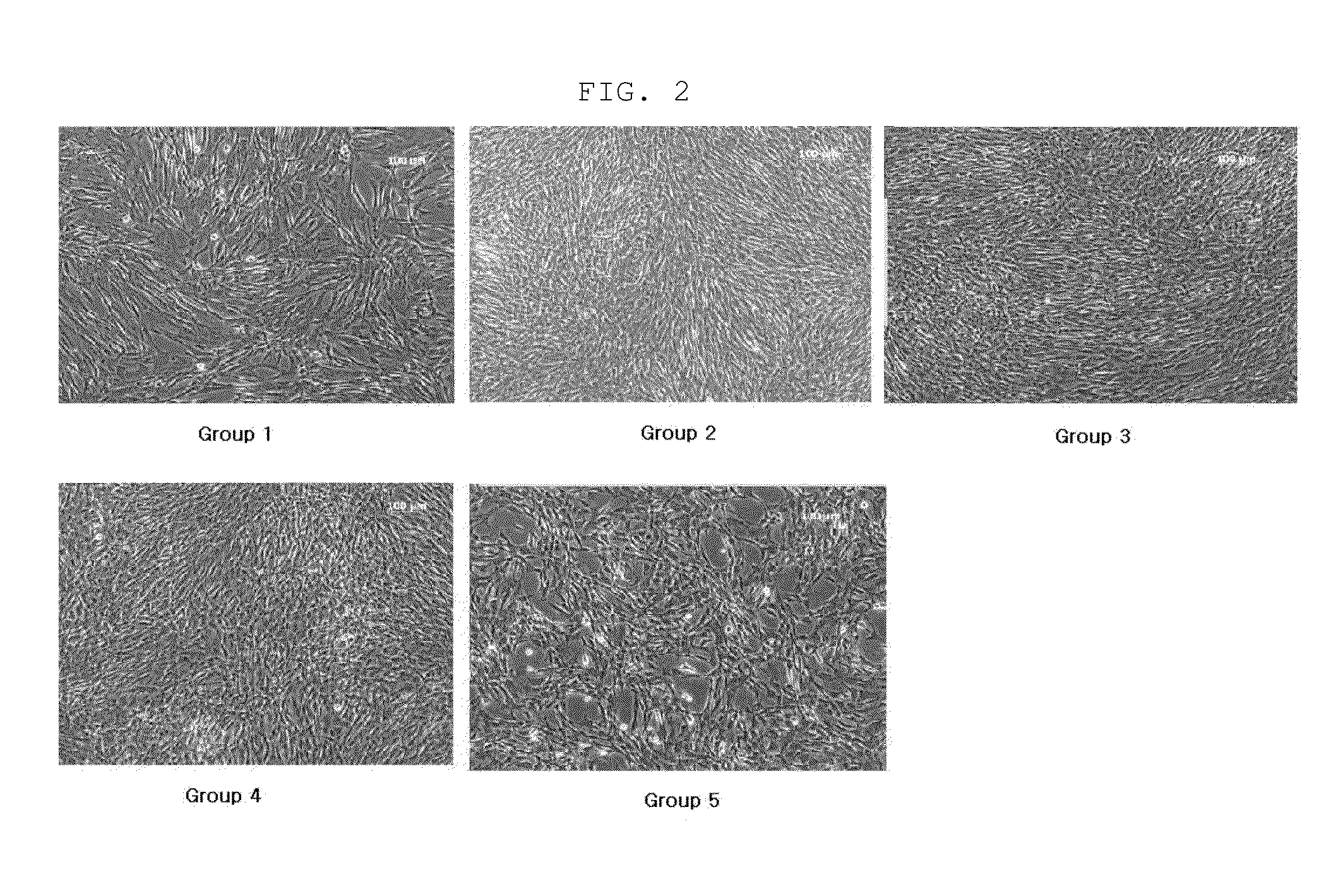 Culture medium composition for culturing amnion-derived mesenchymal stem cell, and method for culturing amnion-derived mesenchymal stem cell by using same