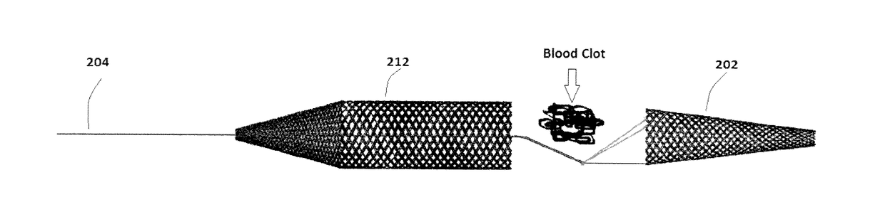 Embolus Removal Device with Blood Flow Restriction and Related Methods