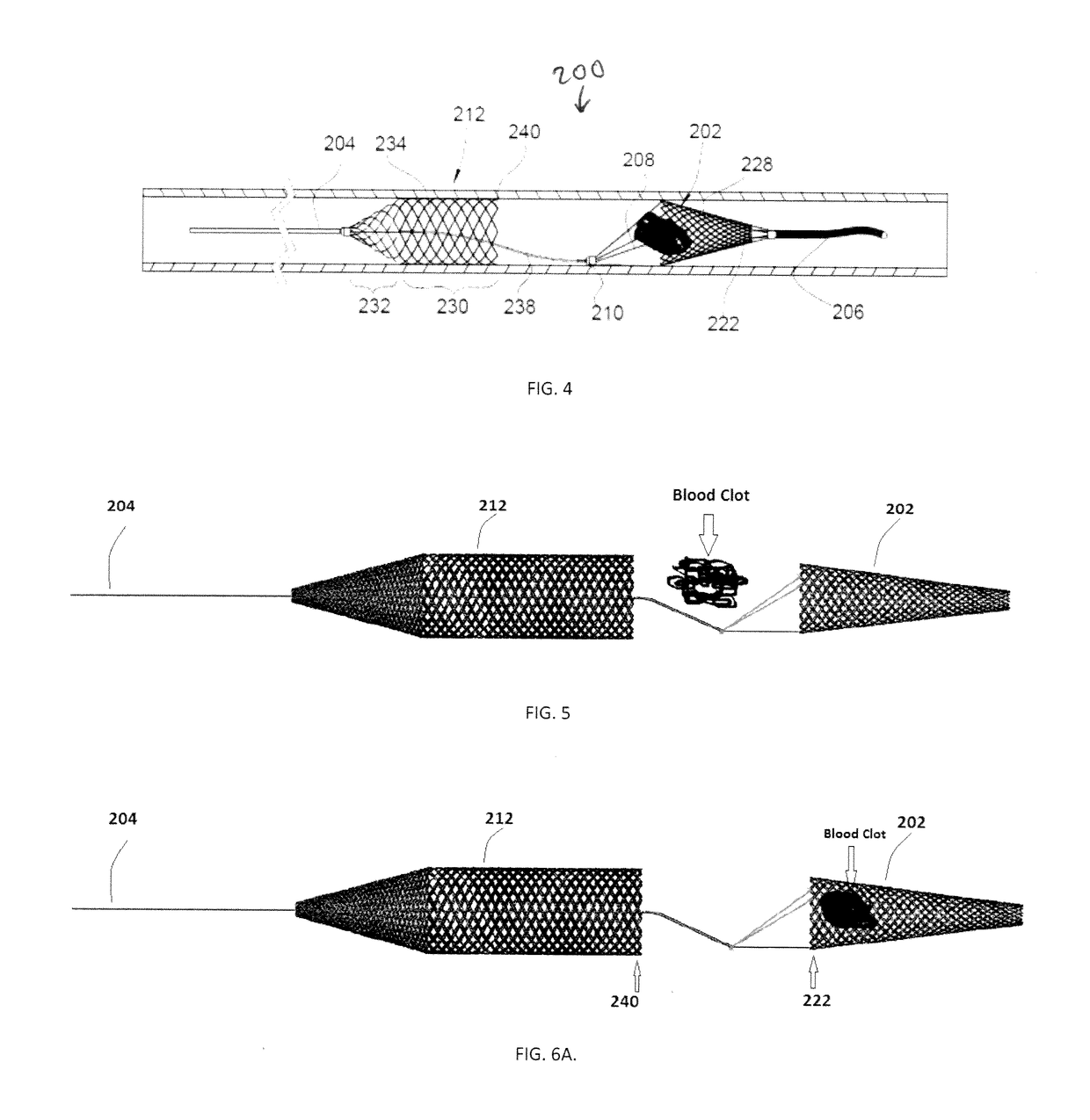 Embolus Removal Device with Blood Flow Restriction and Related Methods