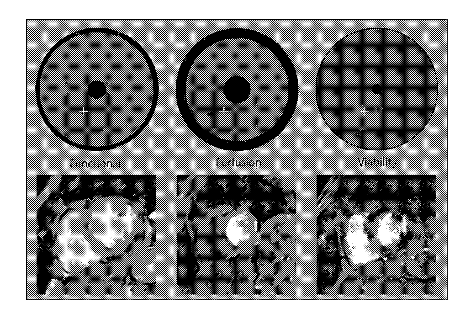 Reparametrized bull's eye plots