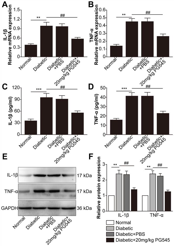 Application of picamod in preparation of medicine for treating diabetic retinopathy