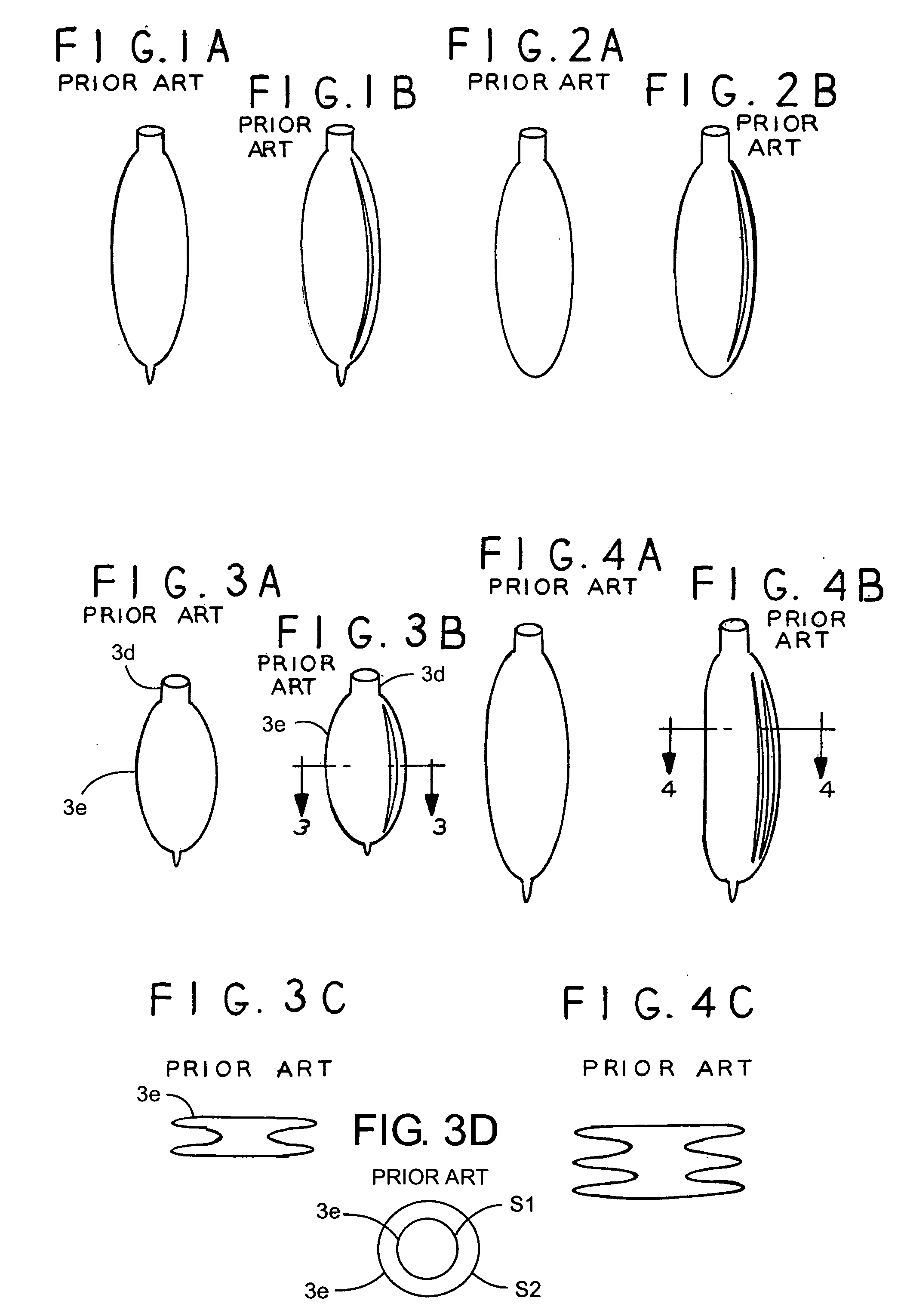 Breathing bag including integrally formed connector and distensible portions