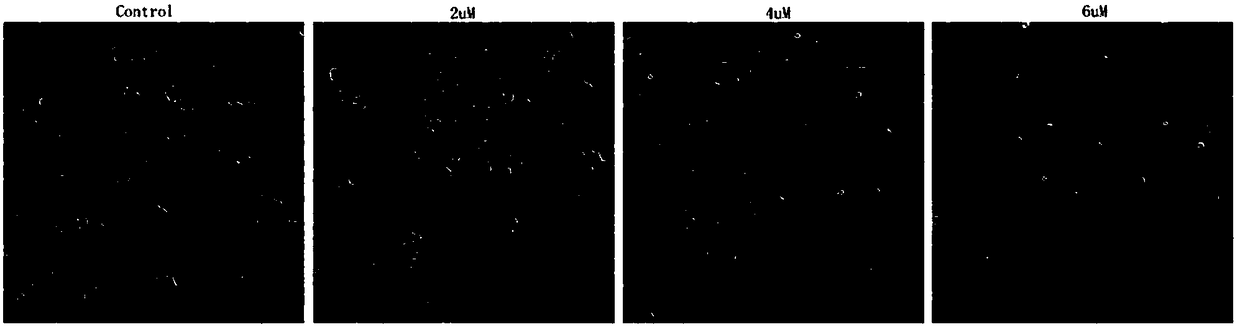 Application of 3beta-hydroxynorerythrosuamine-3-O-beta-D-glucopyranoside to preparing antitumor pharmaceutic preparation