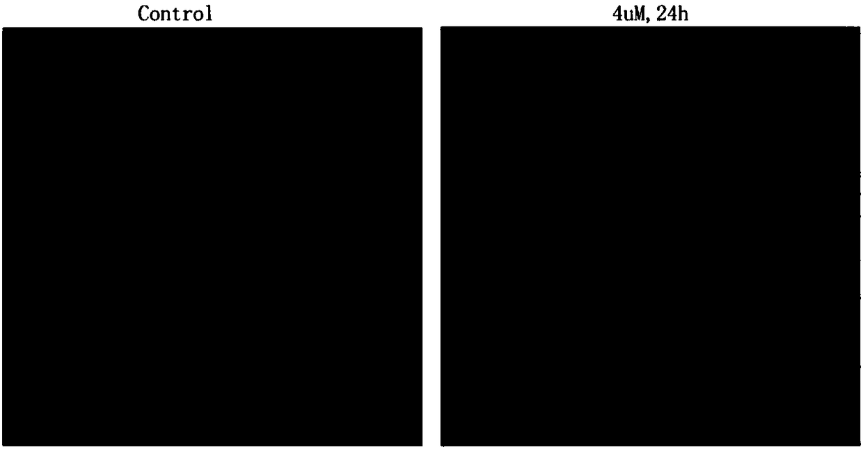 Application of 3beta-hydroxynorerythrosuamine-3-O-beta-D-glucopyranoside to preparing antitumor pharmaceutic preparation