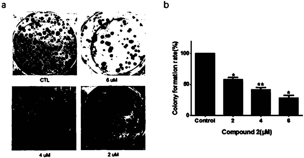 Application of 3beta-hydroxynorerythrosuamine-3-O-beta-D-glucopyranoside to preparing antitumor pharmaceutic preparation