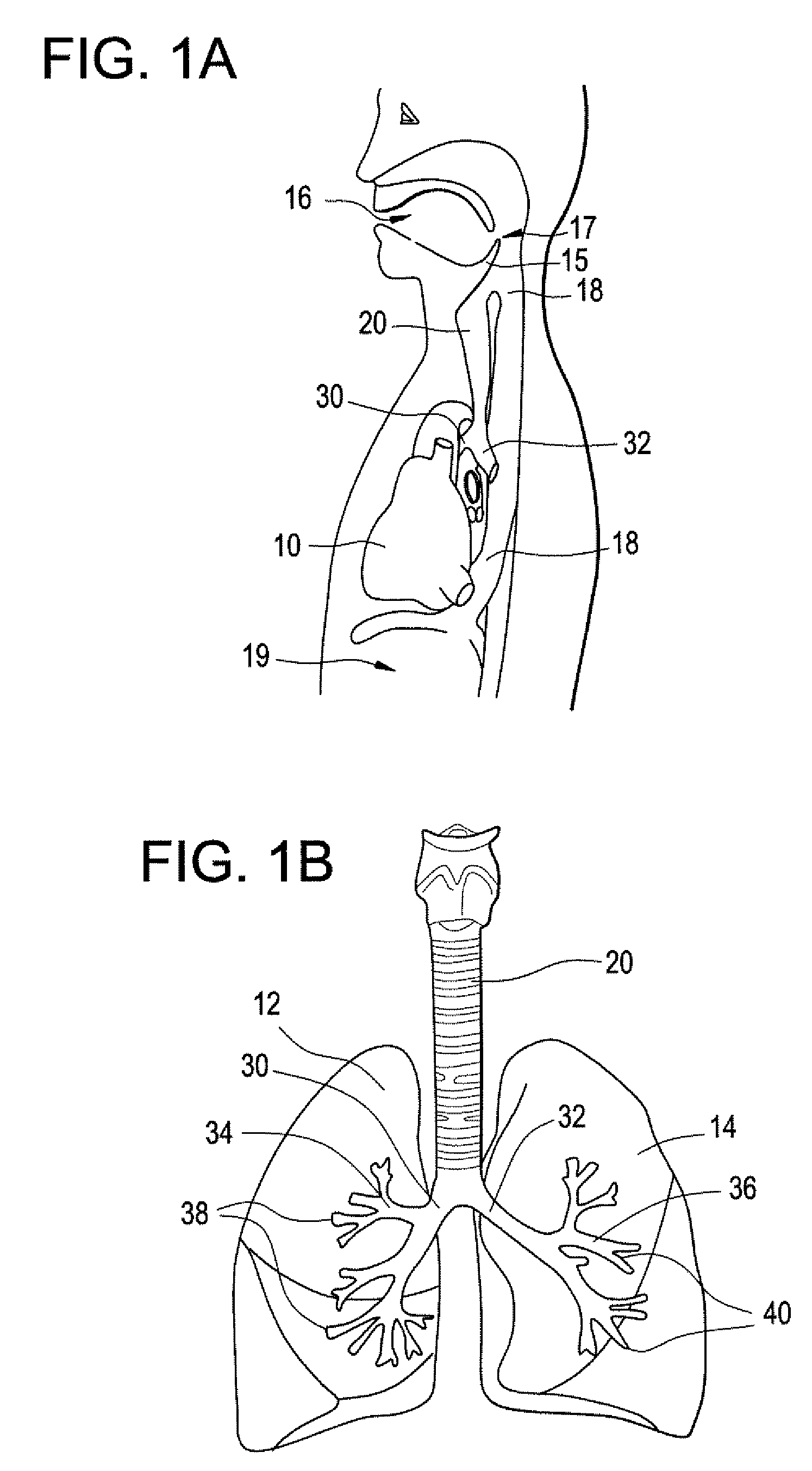 Implantable Devices and Methods for Stimulation of Cardiac or Other Tissues