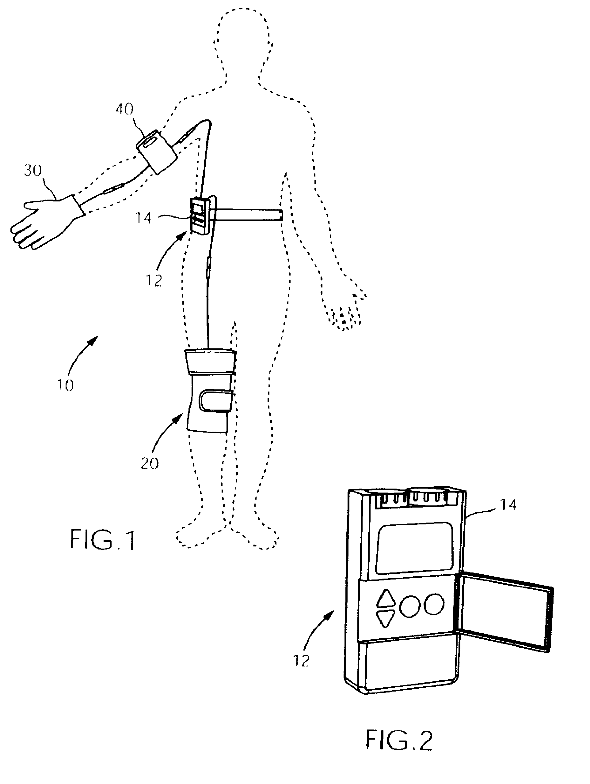 Electrotherapy Stimilator for Osteoarthritis