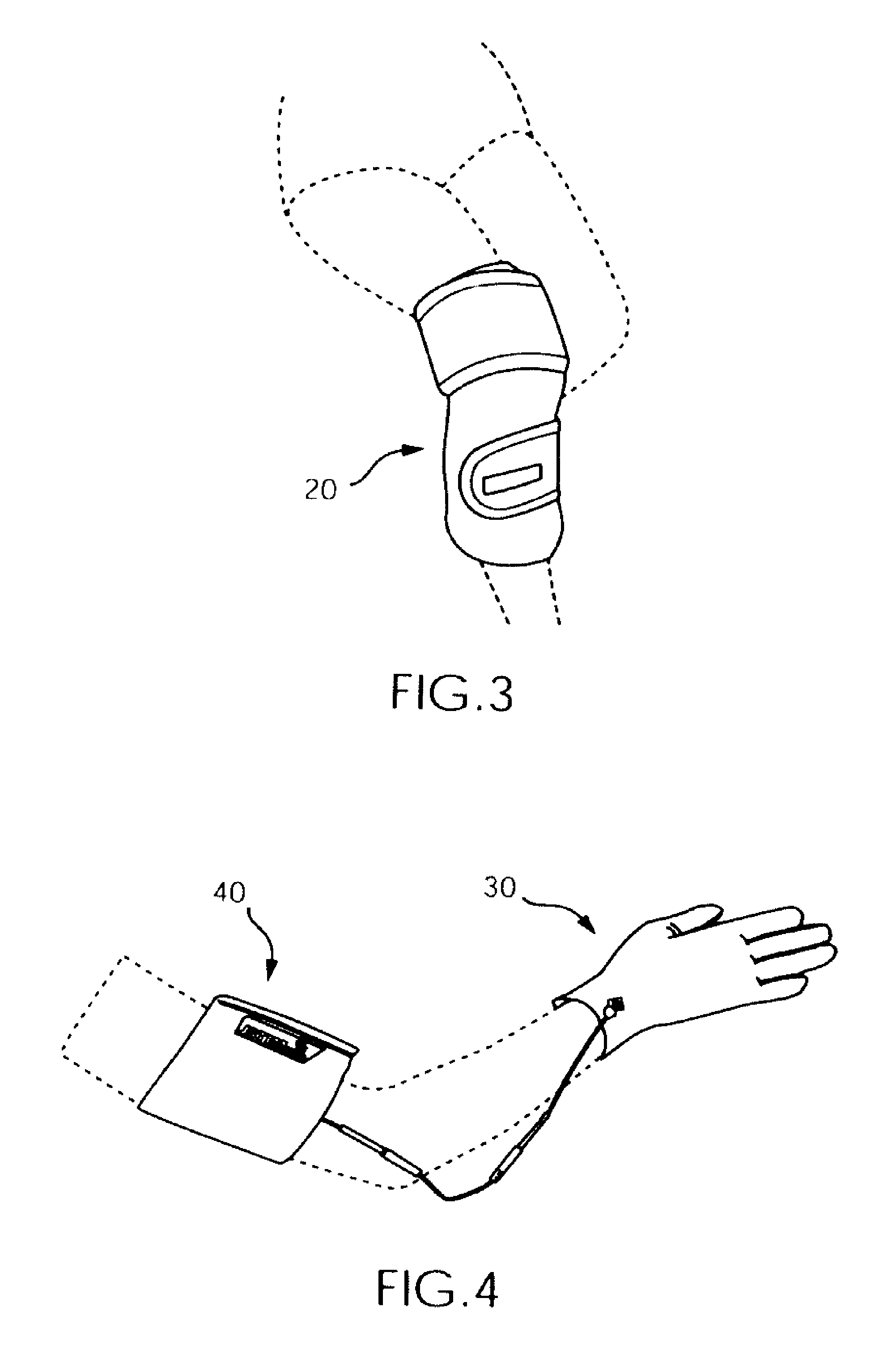 Electrotherapy Stimilator for Osteoarthritis