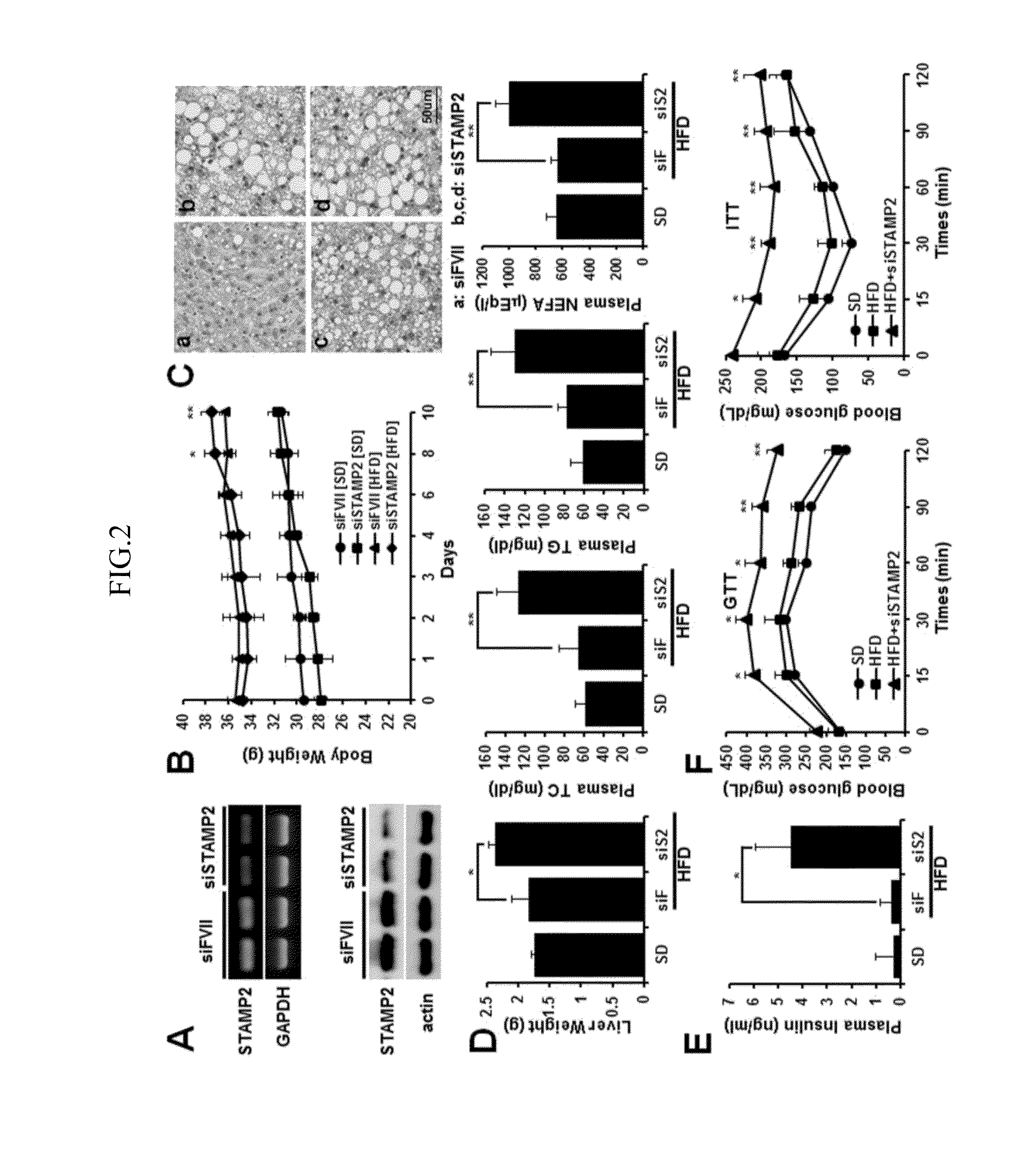 Method for treating or preventing nonalcoholic fatty liver disease