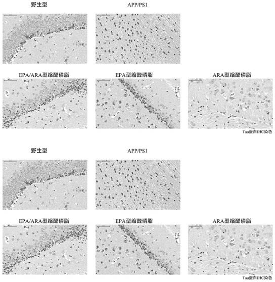 A kind of preparation method and application of epa/ara type plasmalogen