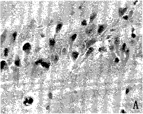 Traditional Chinese medicine for preventing and treating Alzheimer disease and preparation method thereof