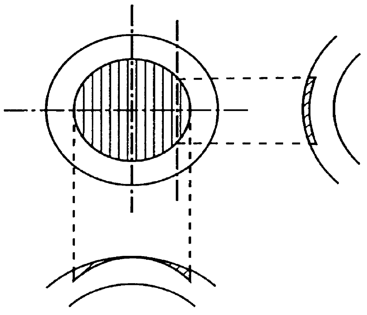 Apparatus for operation on a cornea