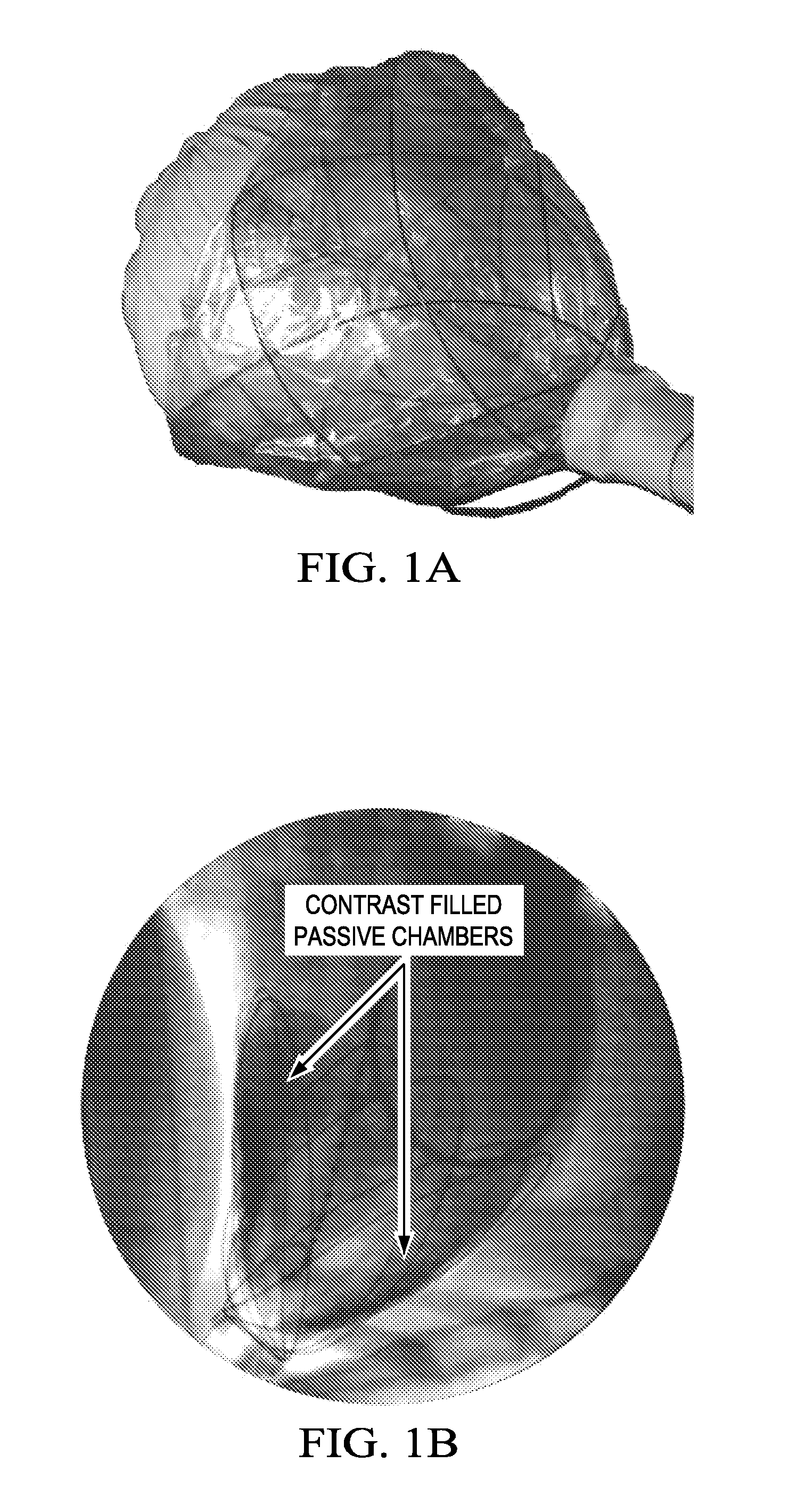 Implantable driver with non-invasive transmural powering device for cardiac assist and combined assist and support devices