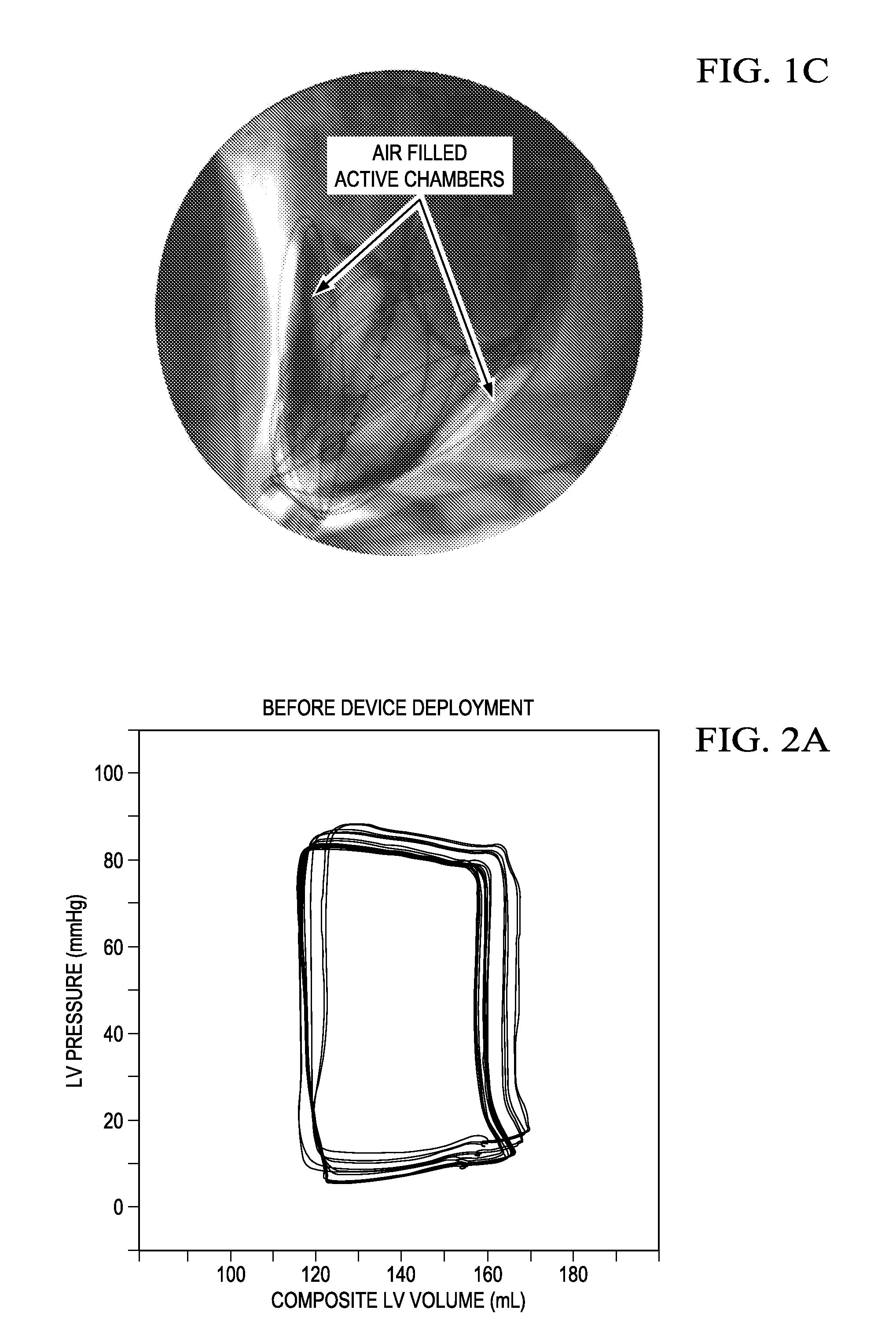 Implantable driver with non-invasive transmural powering device for cardiac assist and combined assist and support devices