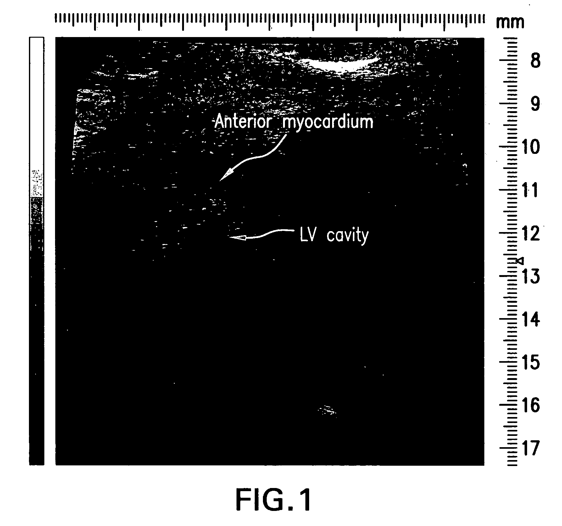 Deposit contrast agents and related methods thereof