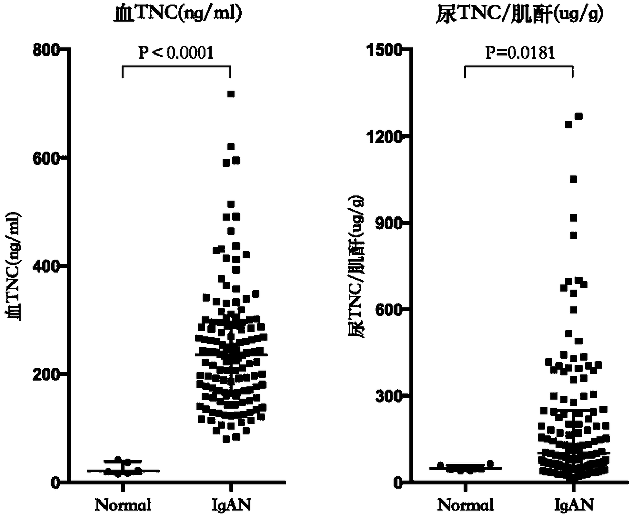 Application of urea Tenascin-C: creatinine in preparing preparation for diagnosing and prognosis evaluating idiopathic IgA nephropathy