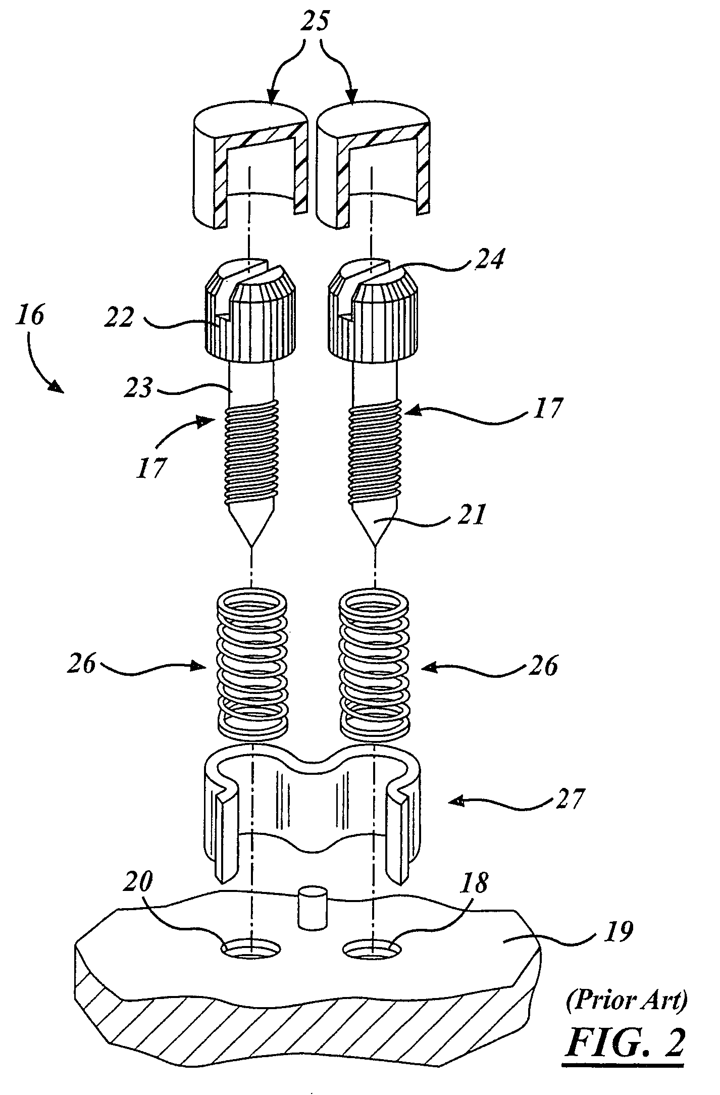 Carburetor fuel adjustment assembly