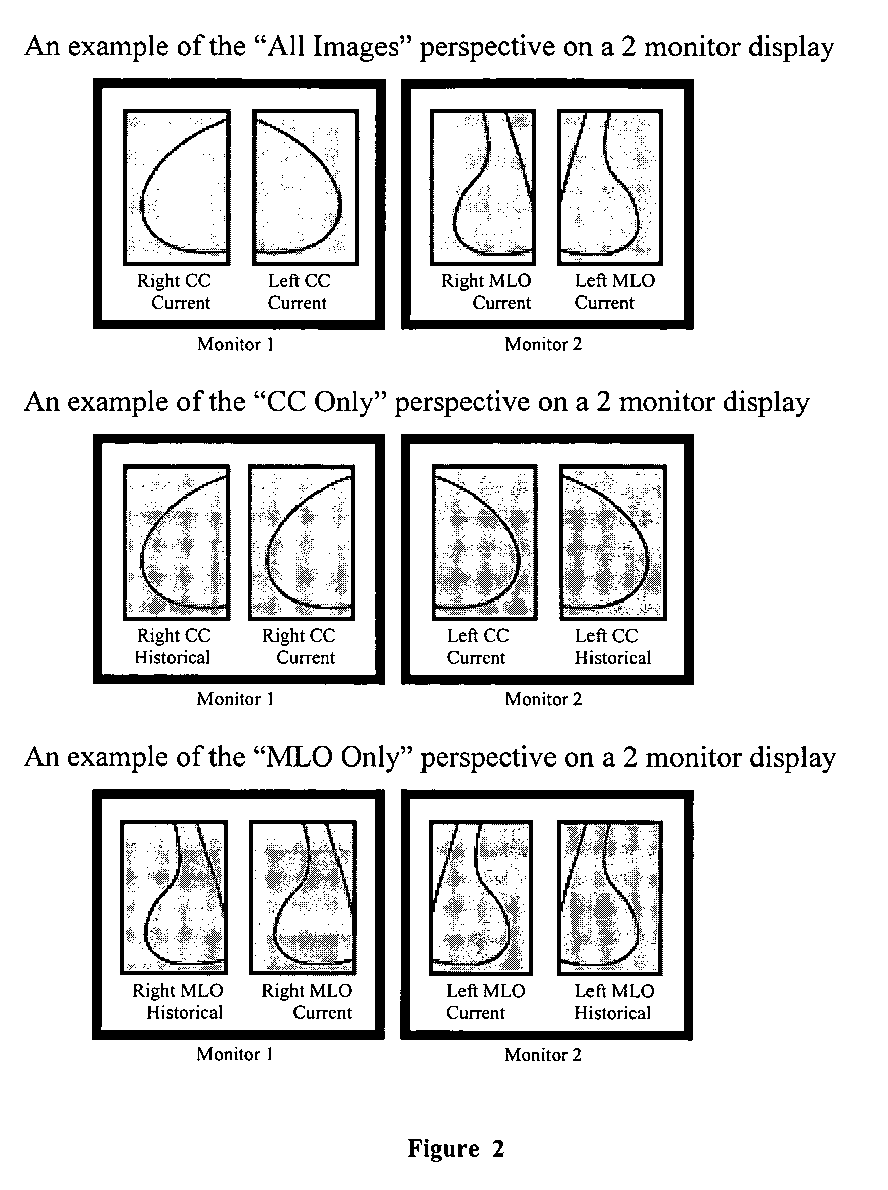 System and method for perspective-based procedure analysis