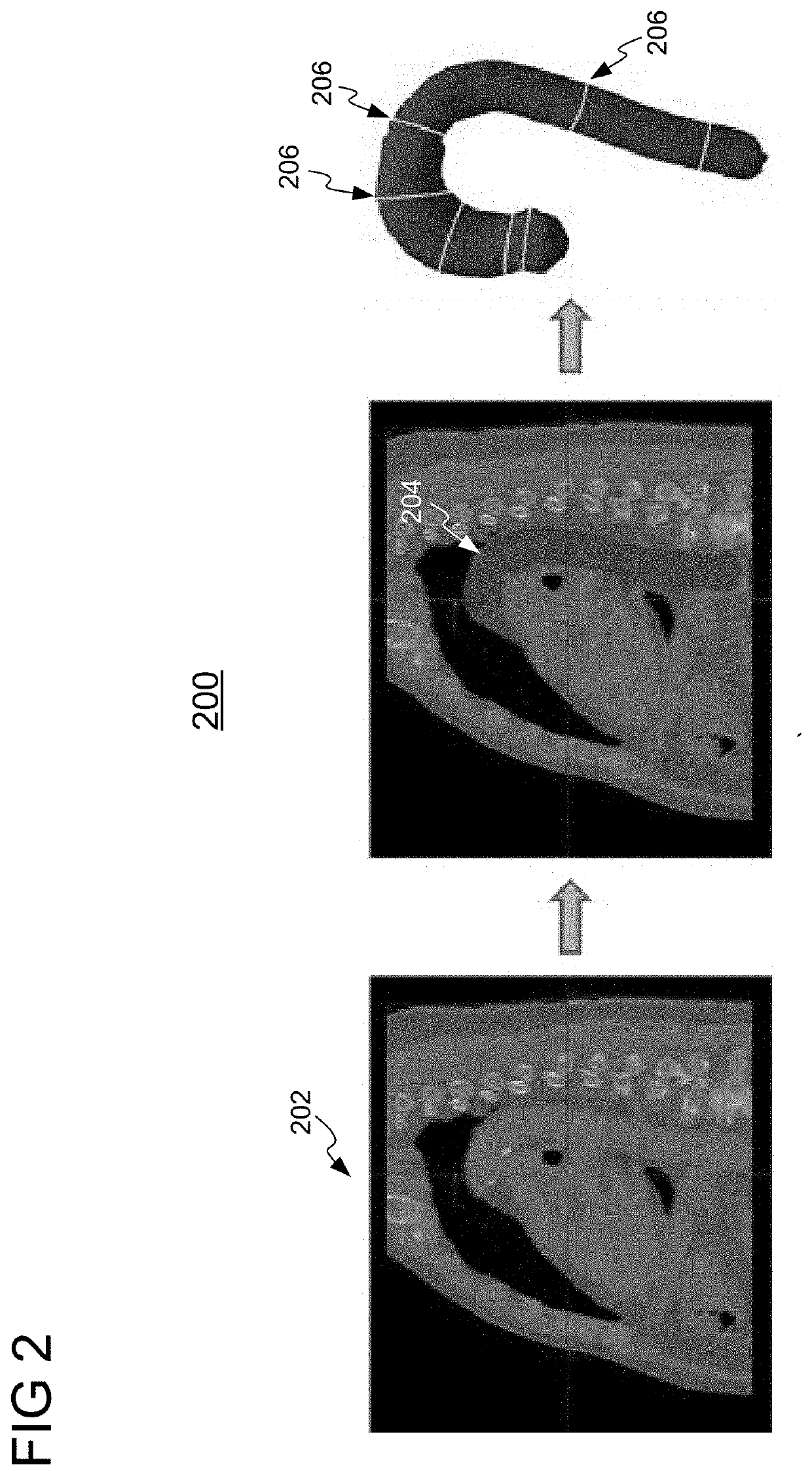 Automatic Detection and Quantification of the Aorta from Medical Images