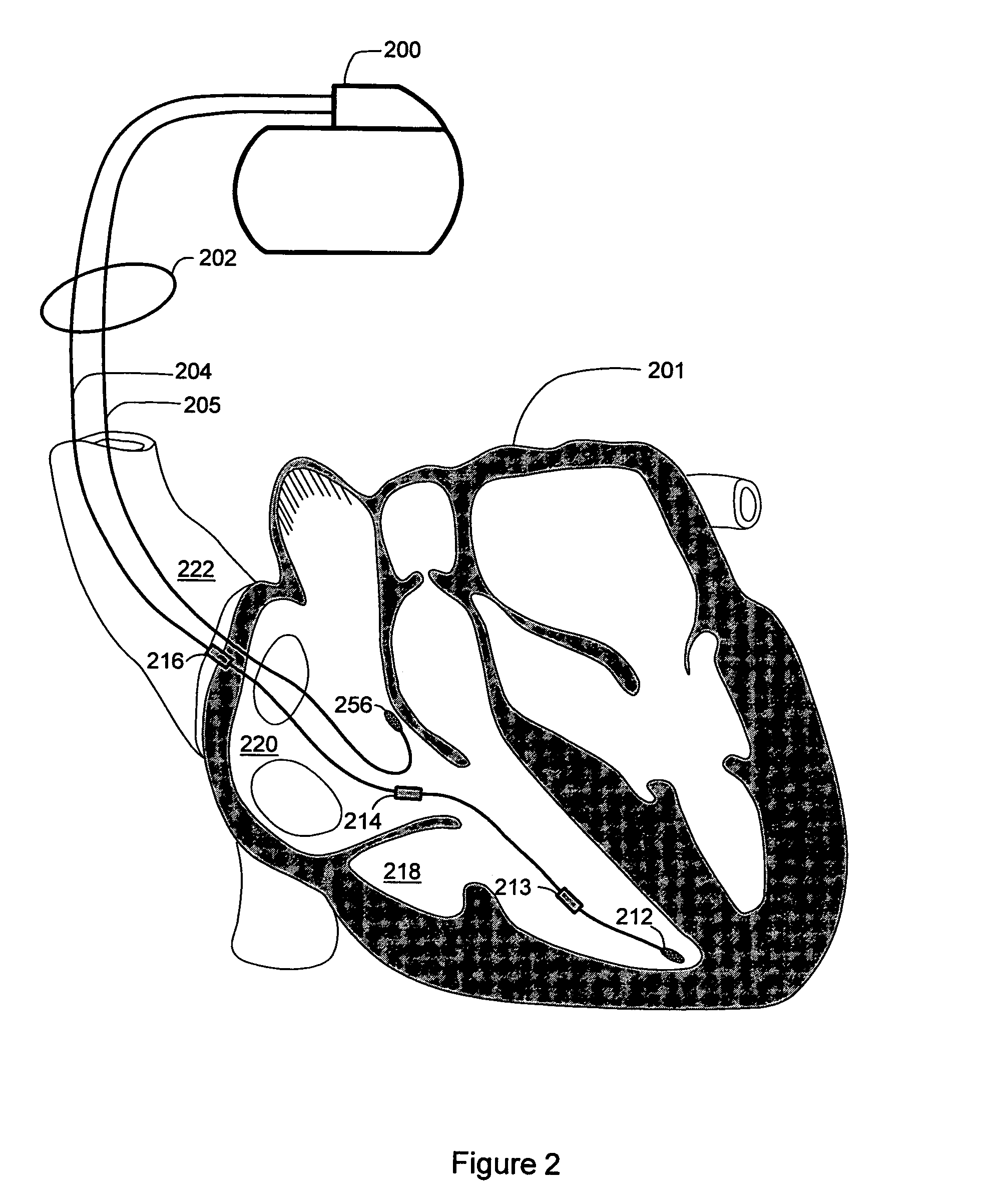 Sleep detection using an adjustable threshold