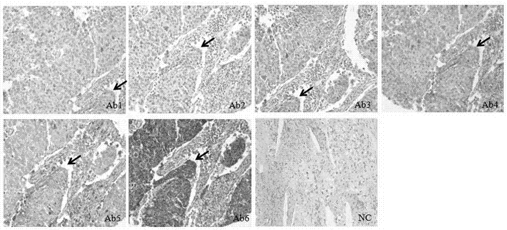 RNA-protein-DNA in-situ multiple staining method of tissue chip