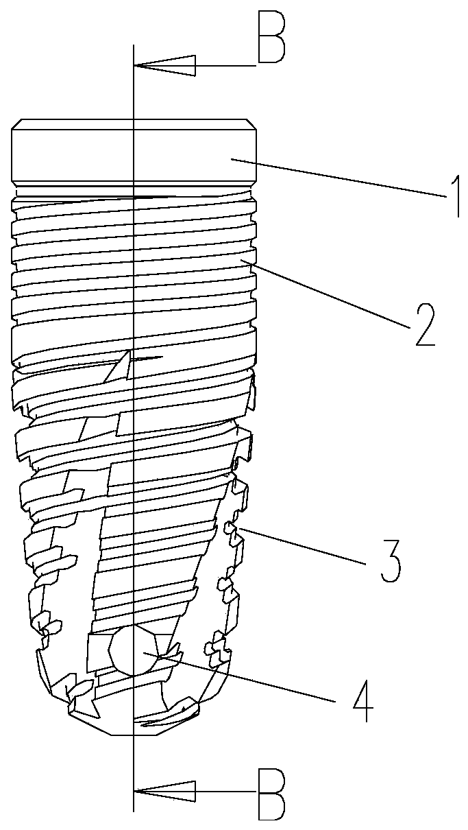 Dental implant with reducing thread