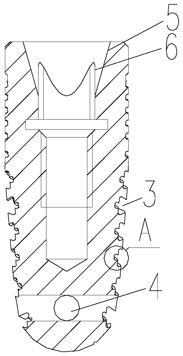 Dental implant with reducing thread