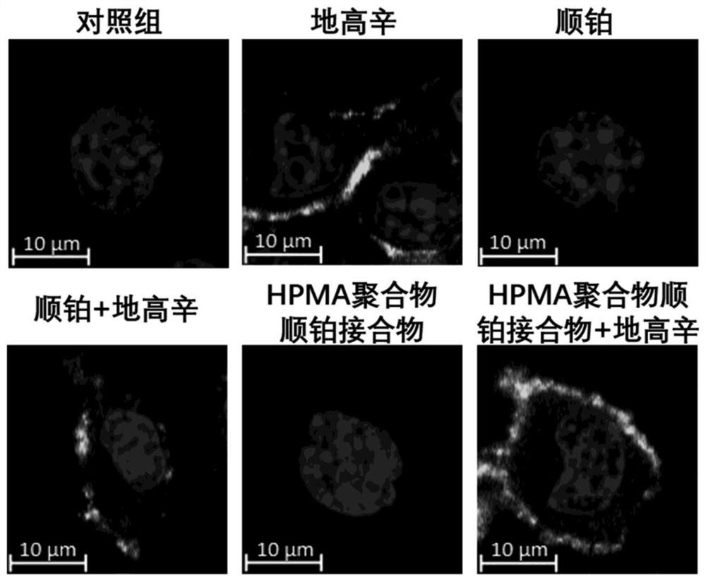 Combined medicine capable of simultaneously amplifying immunogenic cell death and enhancing anti-tumor effect