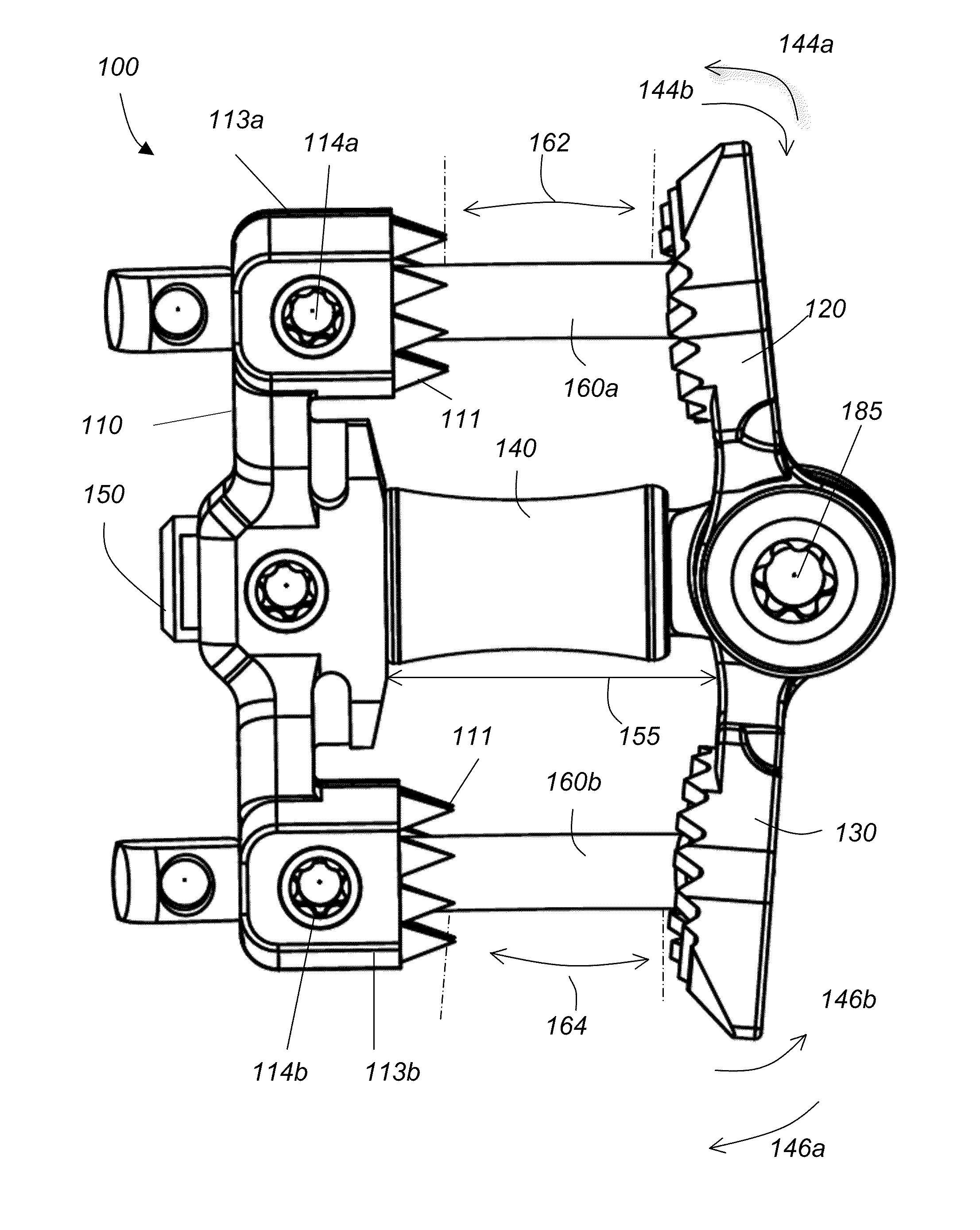 Spinous process fixation implant