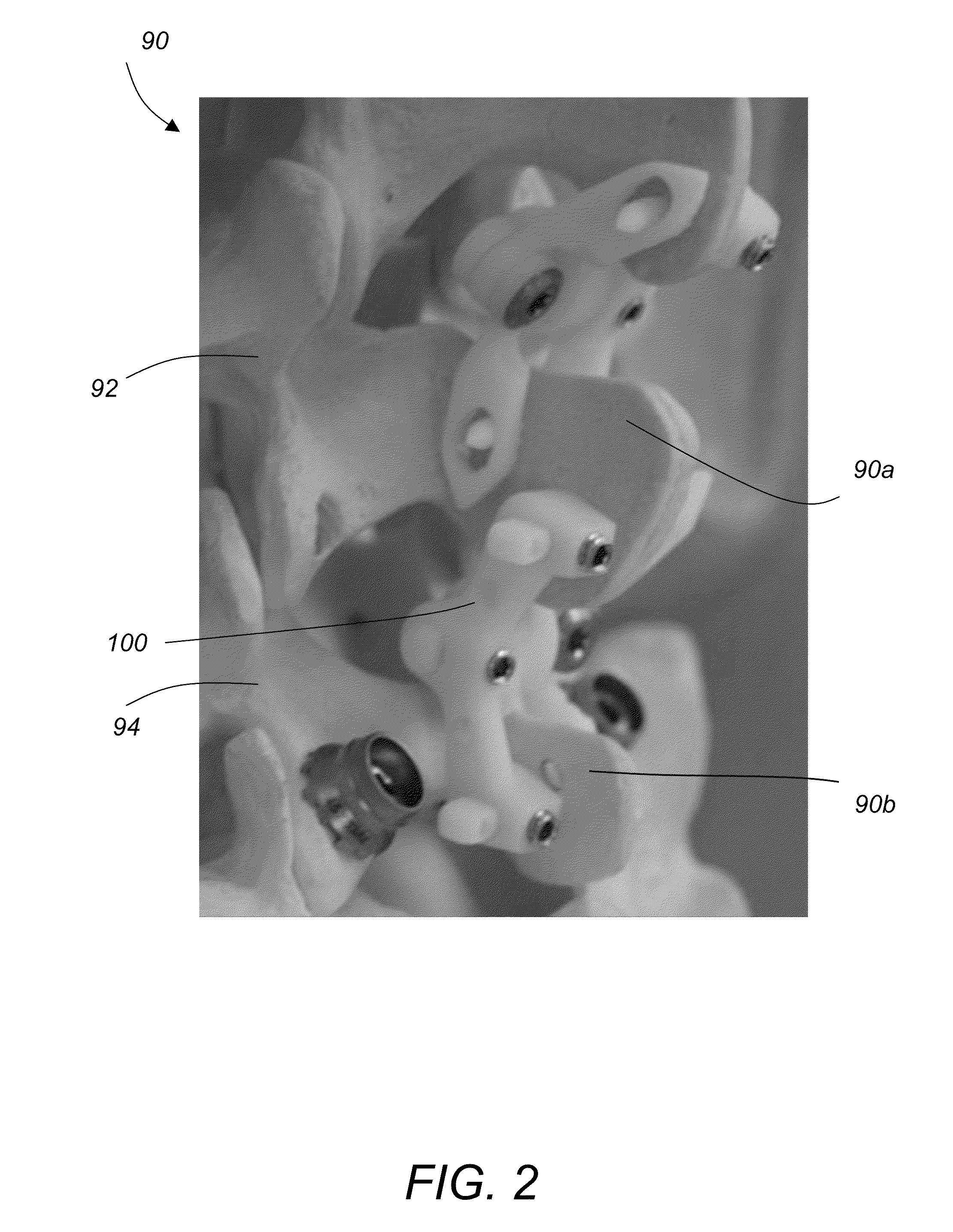 Spinous process fixation implant