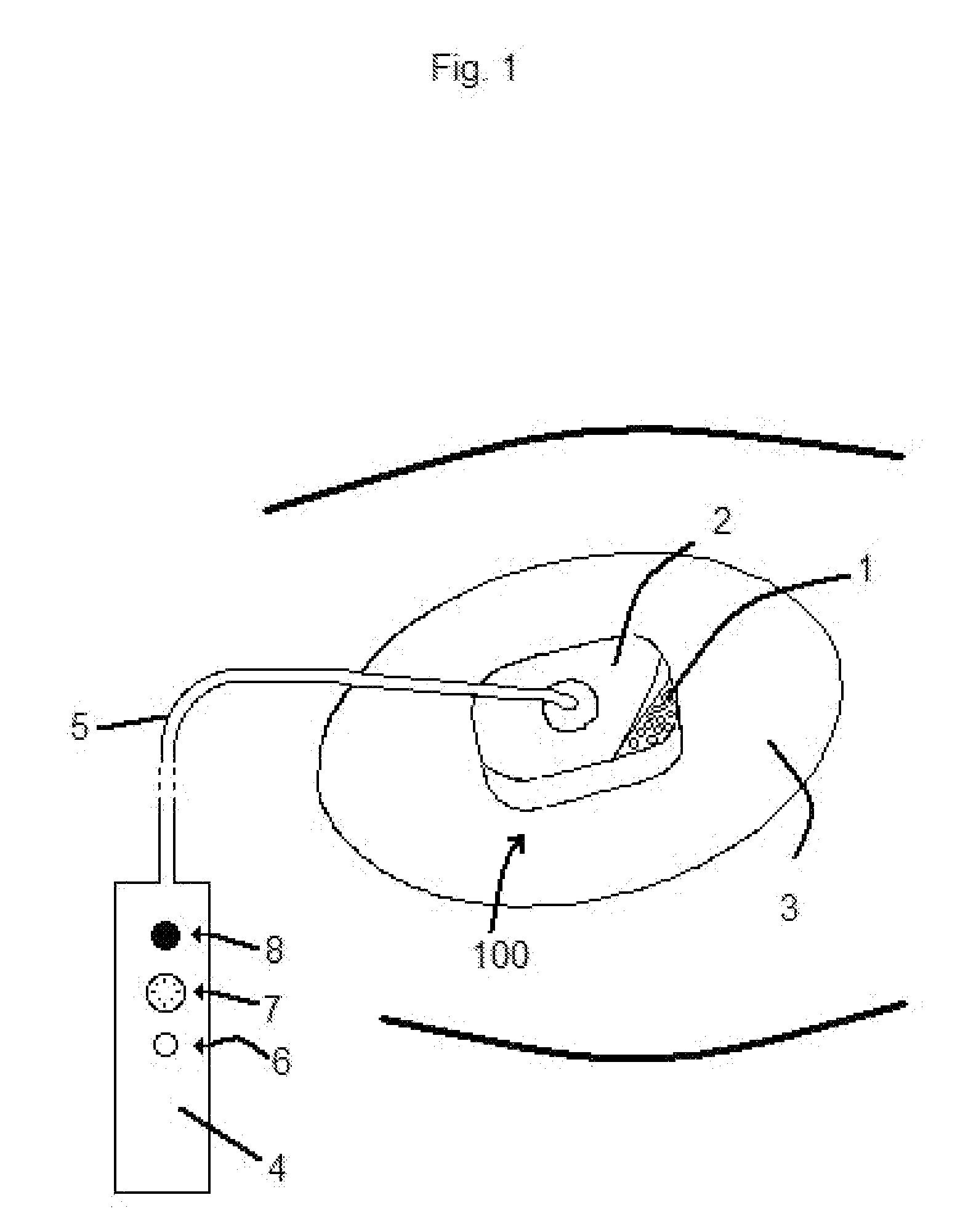 Device for traction wound closure