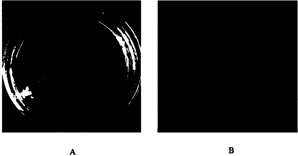 Diethylstilbestrol degradation strain and application thereof in sewage and animal manure treatment