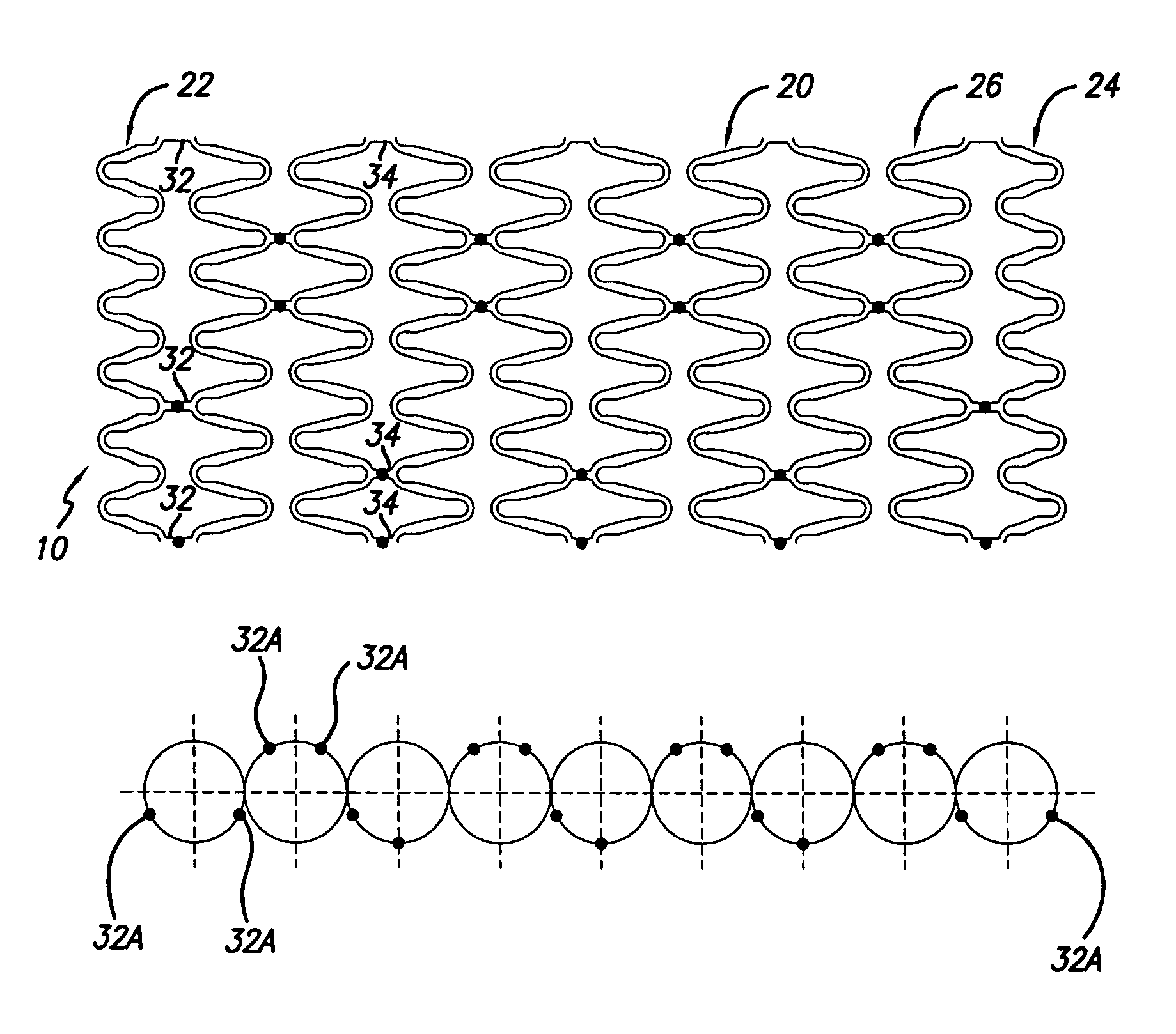 Intravascular stent