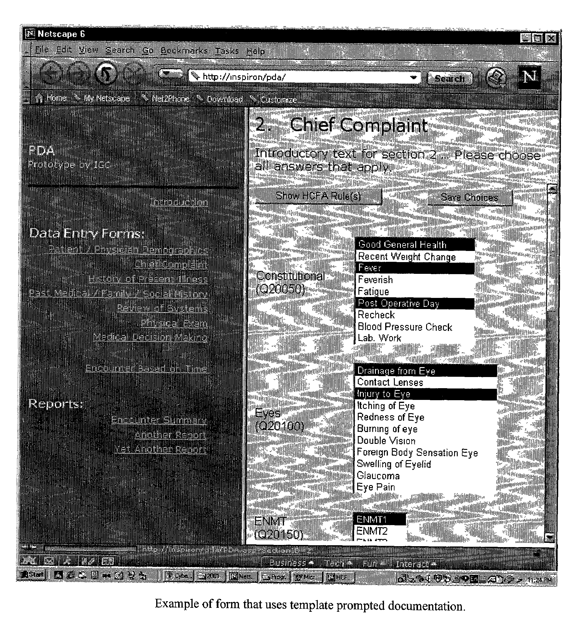 Augmentation system for documentation