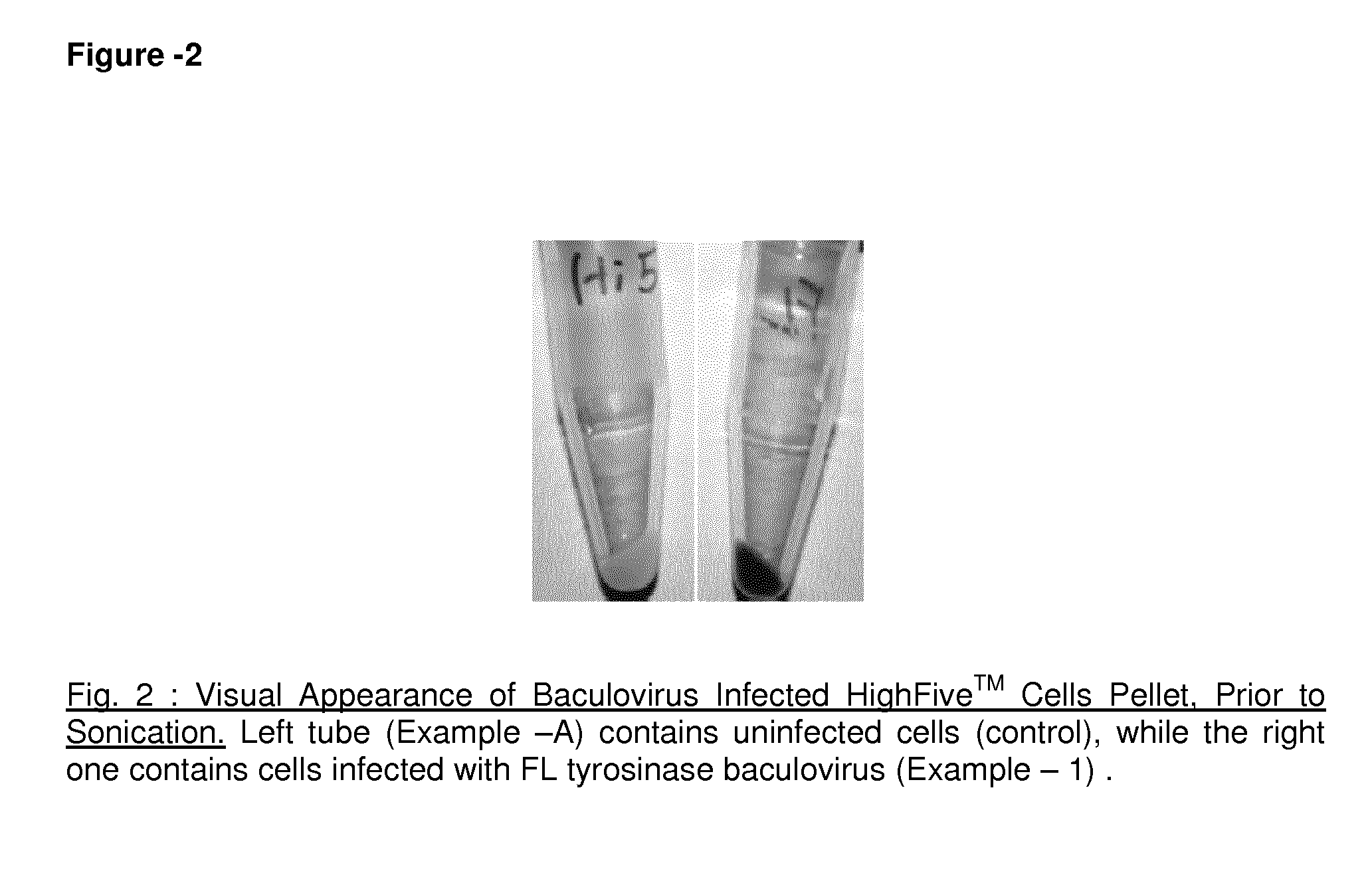 Method of preparing recombinant human tyrosinase