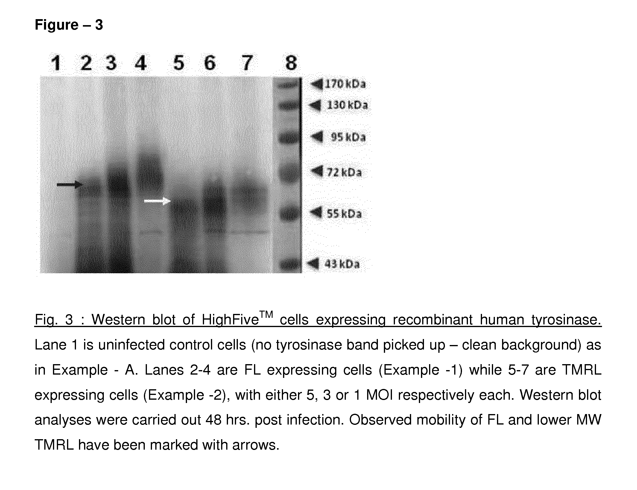 Method of preparing recombinant human tyrosinase