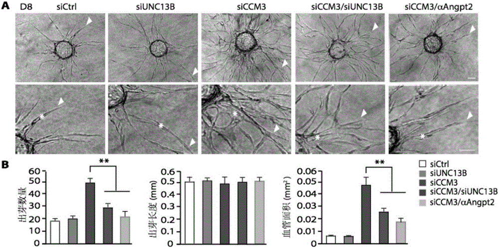 Construction method of cerebral cavernous hemangioma cell model and application of cell model in new drug screening