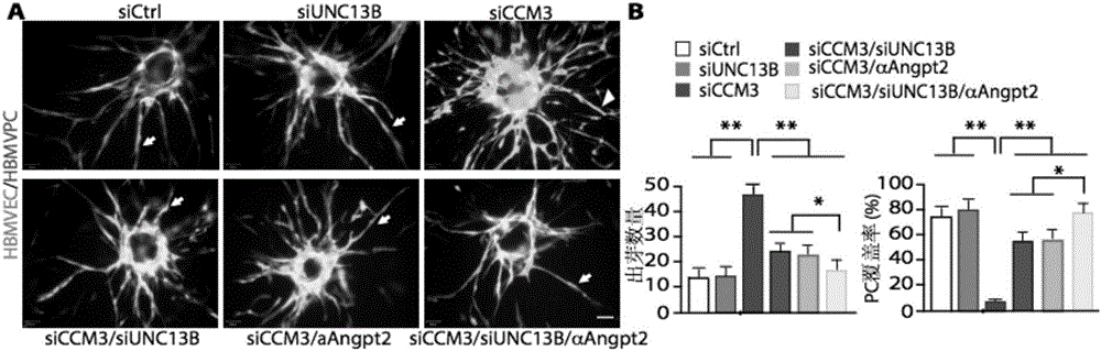 Construction method of cerebral cavernous hemangioma cell model and application of cell model in new drug screening