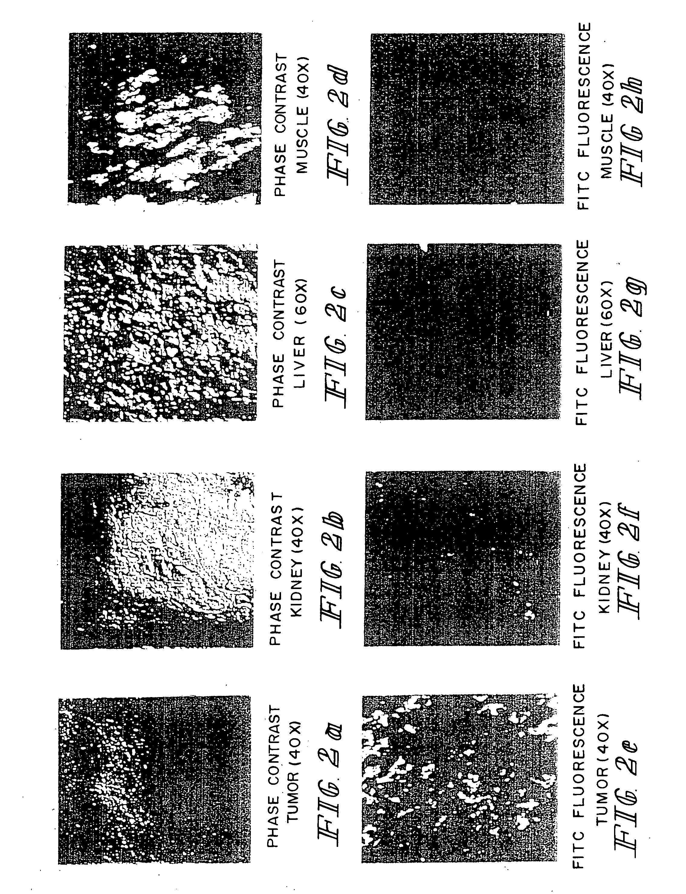 Method of treatment using ligand-immunogen conjugates